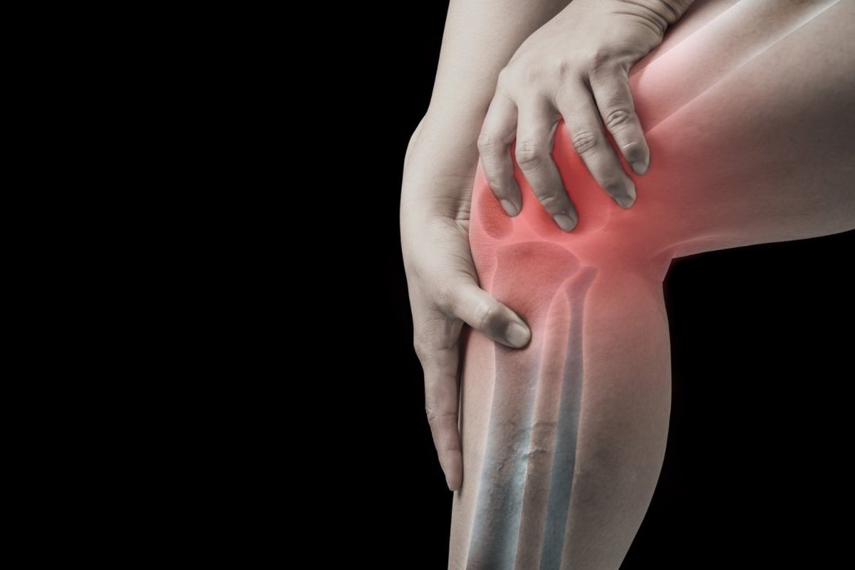 thekneedoc's tweet image. What are the Risk Factors for Repeat Patellar Dislocations?

Many factors need to be assessed when one is looking at #patellarinstability. This is  what you need to know: medilink.us/nxrt  #kneedislocation #sportsmedicine