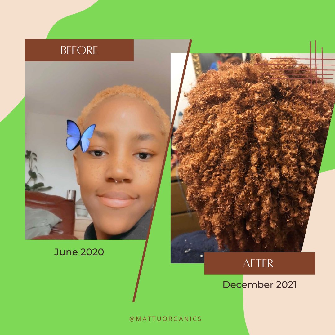 MattuOrganics's tweet photo. Sometimes you’ve got to let go of what’s not serving you anymore and start fresh 🥂

Restored with our root stimulator. Up to 85% off site wide. ( no code needed) 
Shop now at https://t.co/gUxBm1BafY 

#beforeandafter #haircare #hairgrowth #hairstyle https://t.co/xxabd82hCA