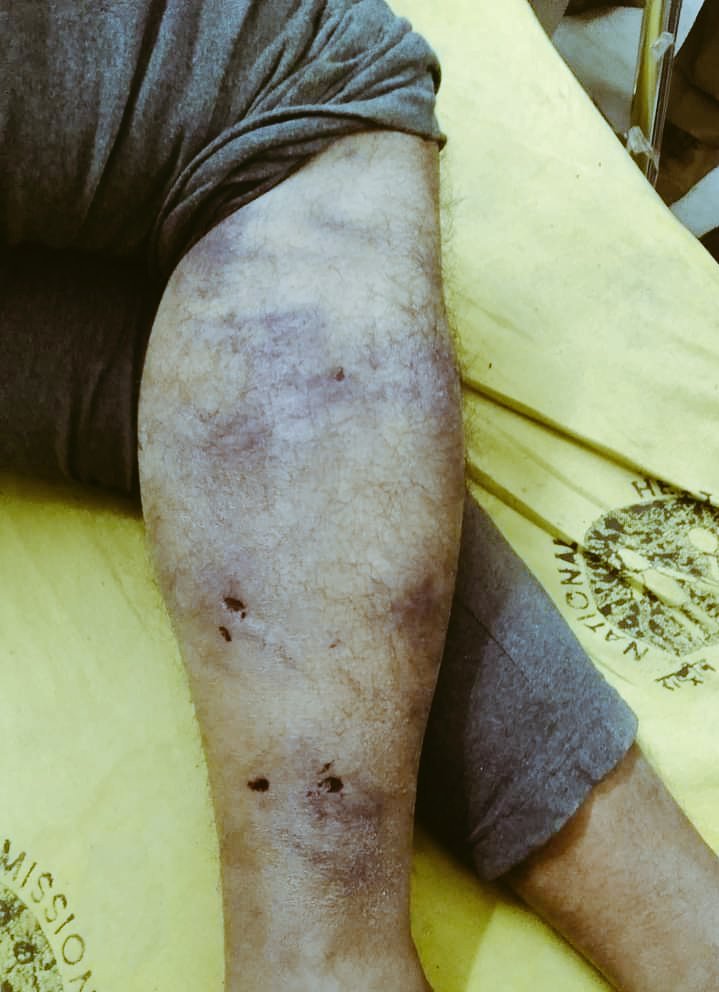 SunilPandayIND's tweet image. #JusticeForPappuDev