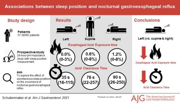 TimVerhagen84's tweet photo. Leuke studie uit het @amsterdamumc in @AmJGastro.
Als je last hebt van nachtelijke #reflux kun je het beste op je linker zij slapen.
De volgende studie gaat blijkbaar onderzoeken hoe je dat dan doet 😁.
#wetenschap #gerd #gerz #fundoplicatie #visualabstract https://t.co/8agOGadwQm