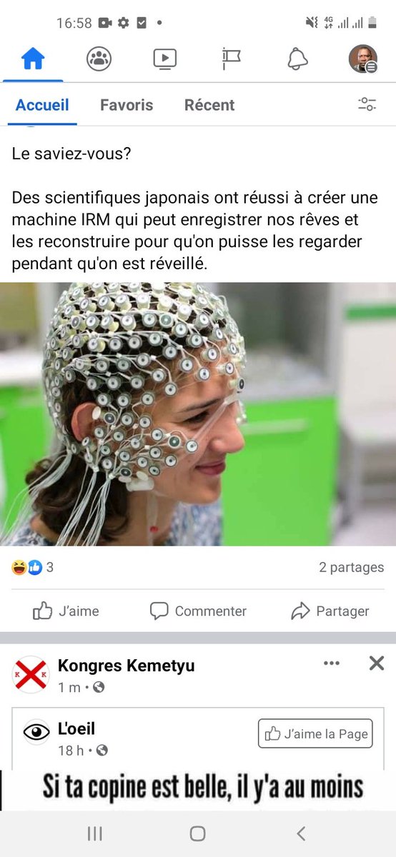 CBINFORMATION's tweet photo. 🛑🤔 Des scientifiques japonais ont créé une machine qui enregistre nos rêves et peut  les reconstruire pour qu'on puisse les regarder pendant qu'on est réveillé👇👇👇 https://t.co/kL3CVZbNL8