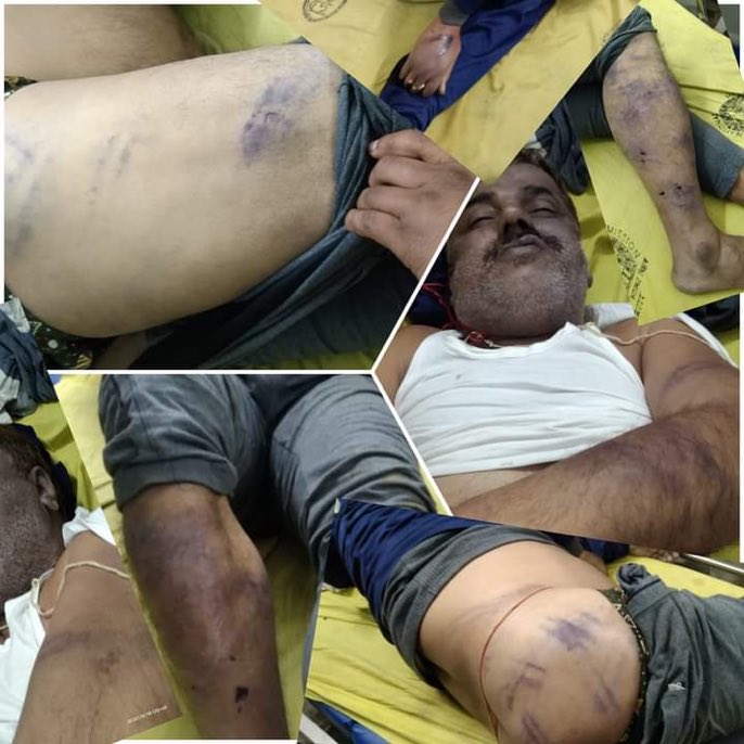 Gajraj_Vivek's tweet image. प्रतिदिन पुलिस थानों में लोगों की निर्मम हत्त्याएँ हो रहीं हैं और देश के प्रधानमंत्री तथा गृहमंत्री धृतराष्ट्र बने हुए हैं  पप्पू देव जी ने समाज की लड़ाई लड़ी उनकी निर्मम हत्या करने वाले प्रशासन और सहभागी सरकार के खिलाफ समाज को एकजुट होना पड़ेगा 
@India_NHRC
#JusticeForPappuDev