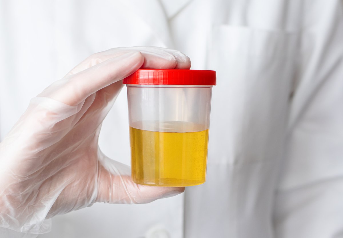 PsychiatristCNS's tweet photo. #BestOf2021 Revisiting our top 10 articles of the year! 

⭐  1️⃣   I Have Never Used Methamphetamine, But My Urinalysis Says I Do: Clinical implications of false-positives in GC/MS tests. https://t.co/nOoiu2oLeu | #MedSM #MedTwitter https://t.co/dWVkXCznsQ
