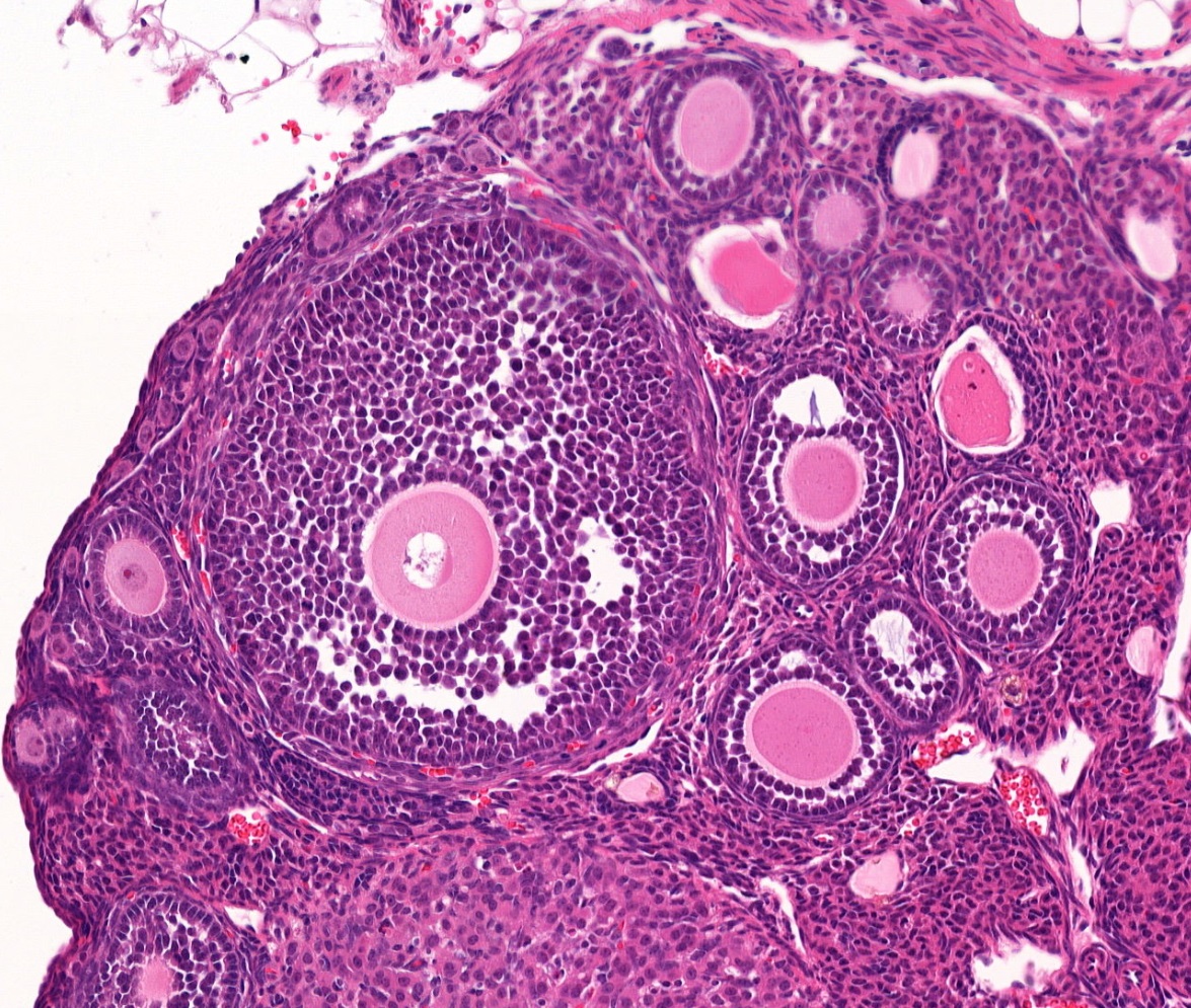 Thank you <a href="/EuropePMC/">Europe PMC articles</a> for sharing our paper and <a href="/BBSRC/">Biotechnology and Biological Sciences Research</a> for supporting our research!

"Epigenetic regulation of 5α reductase-1
underlies adaptive plasticity of reproductive
function and pubertal timing"
<a href="/LabPMelamed/">PhilippaMelamedLab</a>