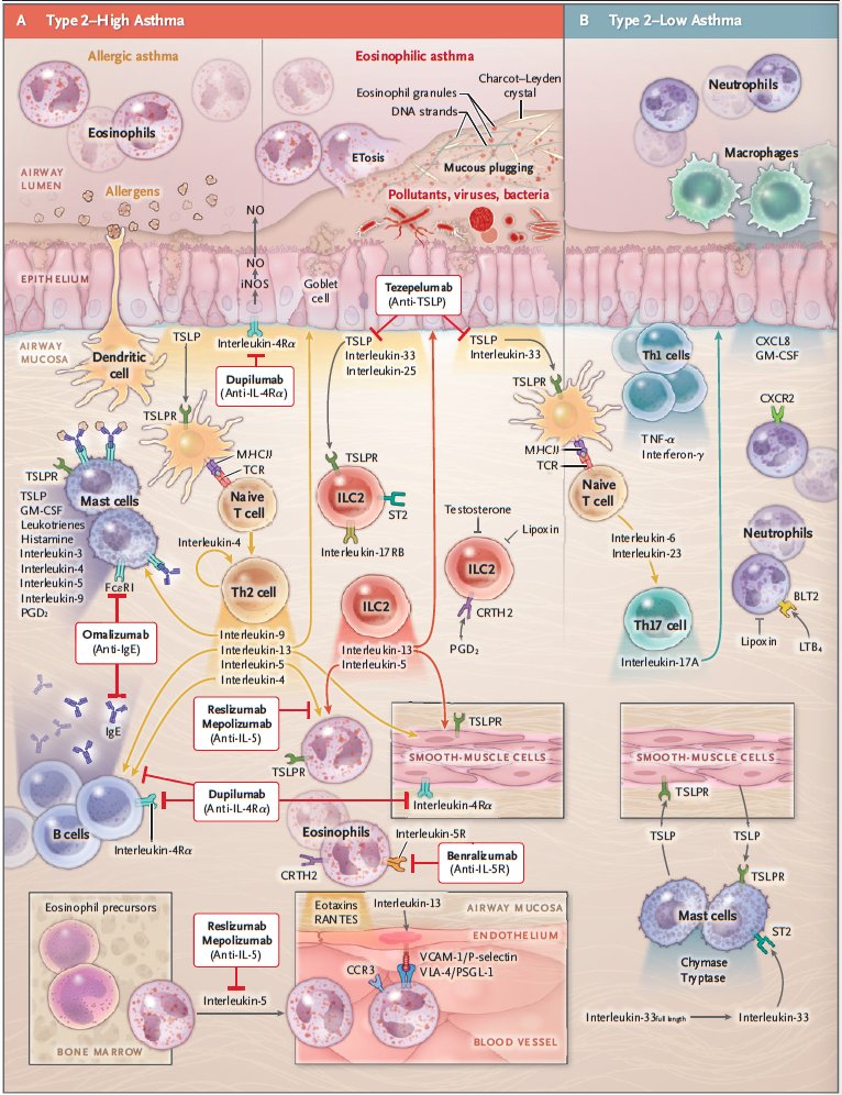 Very insightful and educational illustration of airway inflammation in severe asthma and targets for biological therapies @NEJM #MedEd nejm.org/doi/pdf/10.105…