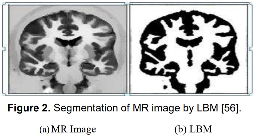 Read about the medical image segmentation techniques based on the Lattice Boltzmann method, that guarantee excellent image processing quality in the most cited article of 2021 in the #EAIEndorsedTransactions on Pervasive Health and Technology

eudl.eu/doi/10.4108/ea…
#openaccess