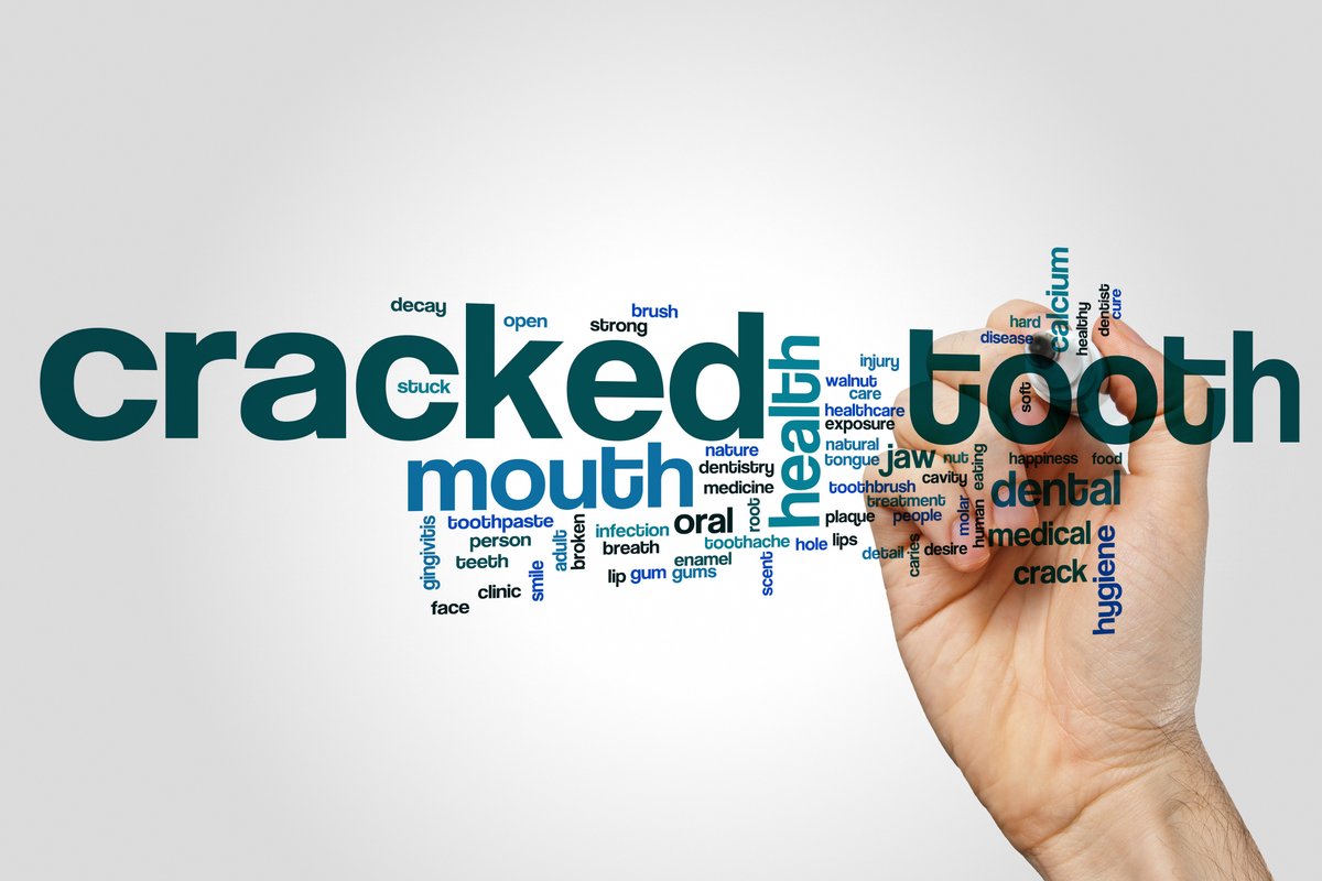 HallmarkLab's tweet image. "Dentists see pandemic stress in patients with more grinding, cracked, broken teeth" That's what we're seeing too.  An ounce of prevention ( #nightguard ) is worth a pound of cure (#crackedtooth )

#carbon

ow.ly/J5VL50HilX2
