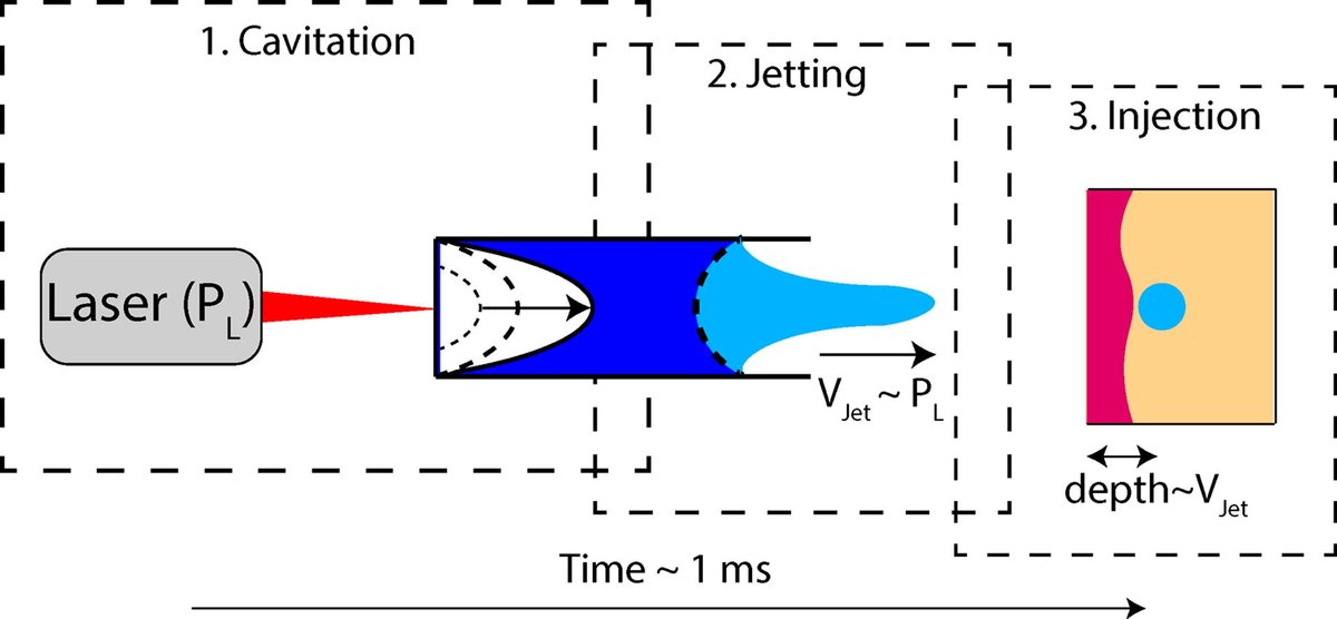 ADDReditors's tweet photo. ADDR in press: "Jet injectors: Perspectives for small volume delivery with lasers"
By Jelle Schoppink & David Fernández Rivas @UTwente
#needlefreeinjection #jetinjector #transdermaldelivery
https://t.co/xjdLm0MrNl https://t.co/kK63QXP4gM