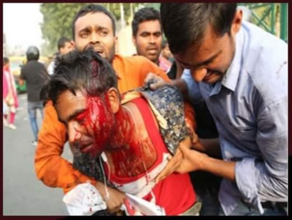 KushwaVikash's tweet photo. #69000_शिक्षक_भर्ती_आरक्षण_घोटाला
फर्क तो साफ है शिक्षामंत्री @drdwivedisatish जी, हक मांगने गए पिछड़े वर्ग के अभ्यर्थी के साथ ये हुआ।
अब तो पिछड़ों के नेता ने भी BJP का साथ छोड़ दिया।
@SwamiPMaurya
@myogiadityanath
@kpmaurya1 https://t.co/ArSqUJ16k2
