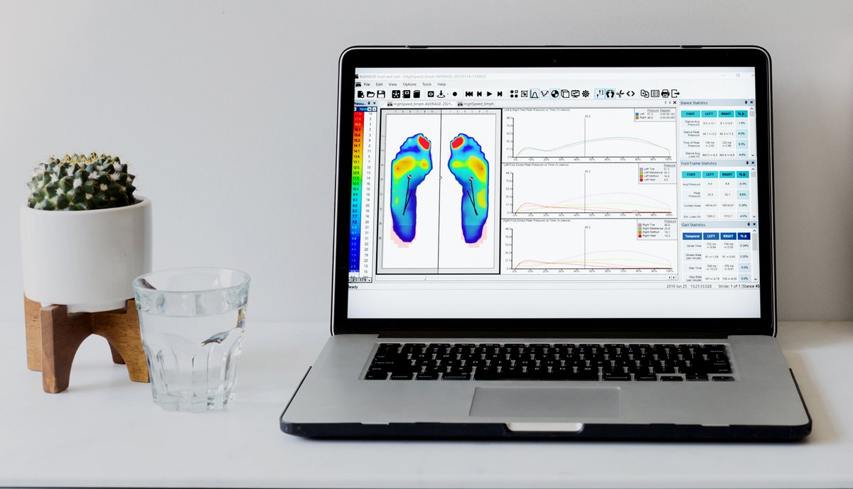 XSENSOR's tweet image. To successfully monitor athletic performance using #PlantarPressure technology, a baseline profile is needed—particularly if an injury occurs, it can be used to help with rehabilitation.

#IntelligentDynamicSensing #Biomechanics #GaitAnalysis #PressureMapping