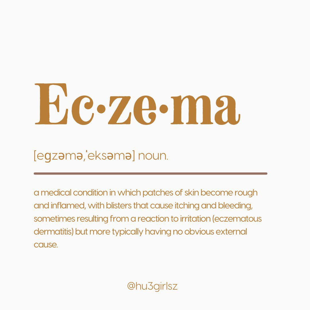 huegirlsz's tweet photo. Suffering from eczema can be so frustrating. If you are hesitant to post publicly, don’t be. The best part for me has been the many people that have contacted me to either ask for support or offer advice. Find your tribe! #eczema #eczemaproblems https://t.co/9tAhWcwjB9