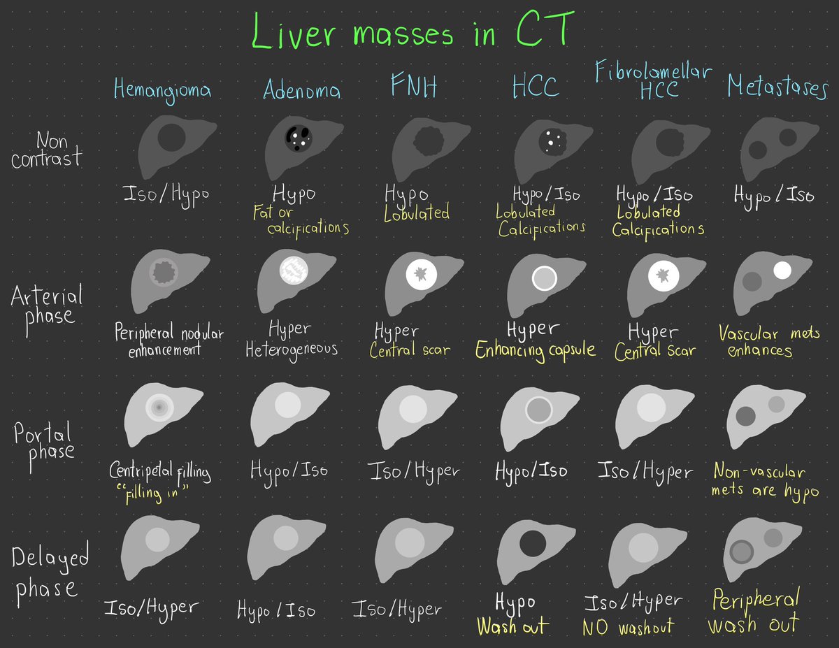 Illustrations have helped me to understand and internalized different concepts in radiology. Hopefully this one that I made will be useful to some of you as well.

#radres #radiology #futureradres #medtwitter