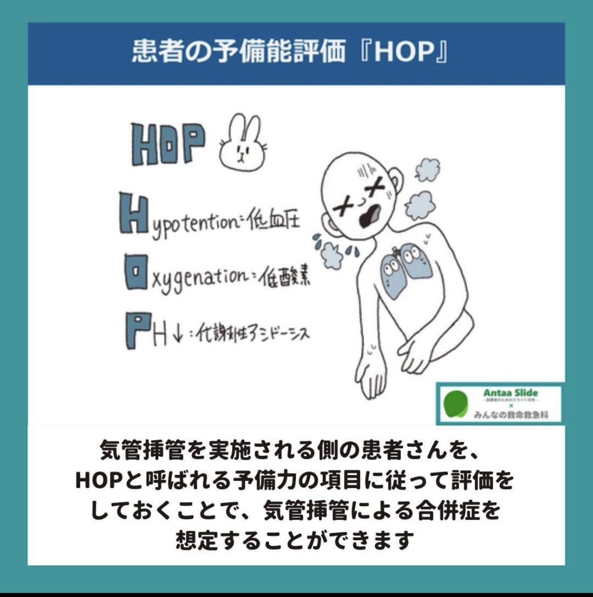 挿管モデル 成人用気道マネキン 研究 教育モデル、経口 鼻腔 挿管 マネキン トレーニング 研究 教育 成人用挿管マネキンモデル 挿管マネキン教育モデル  経口 l 気管挿管シミュレーション 気道管理トレーナー 専門看護師用 緊急教育用 Amazon.co.jp: QLXYYFC 経口経鼻挿管 ..., image size:1170x1178