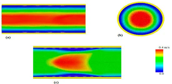 ChemEng_MDPI's tweet image. #call4reading "Fluid-Structure Interaction in Coronary Stents: A Discrete Multiphysics Approach" by Dr. Alessio Alexiadis @AlessioAlexiad1 et al. from @unibirmingham 👏👏
#smooth_particle_hydrodynamics
#lattice_spring_model
#coronary_stent
🧐mdpi.com/2305-7084/5/3/…