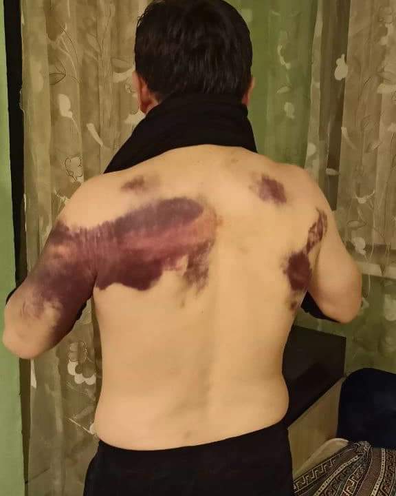 KarabaevGalmjan's tweet photo. 01/12/2022 #Almaty. #Kazakhstan. On January 4, civil activist Aset #Abishev was detained, from that day he was kept in the #Zhetusuisk district police station and he was beaten with concussions and numerous chest injuries..@SecBlinken @rozathun @petras_petras https://t.co/L2mR2jBtjs