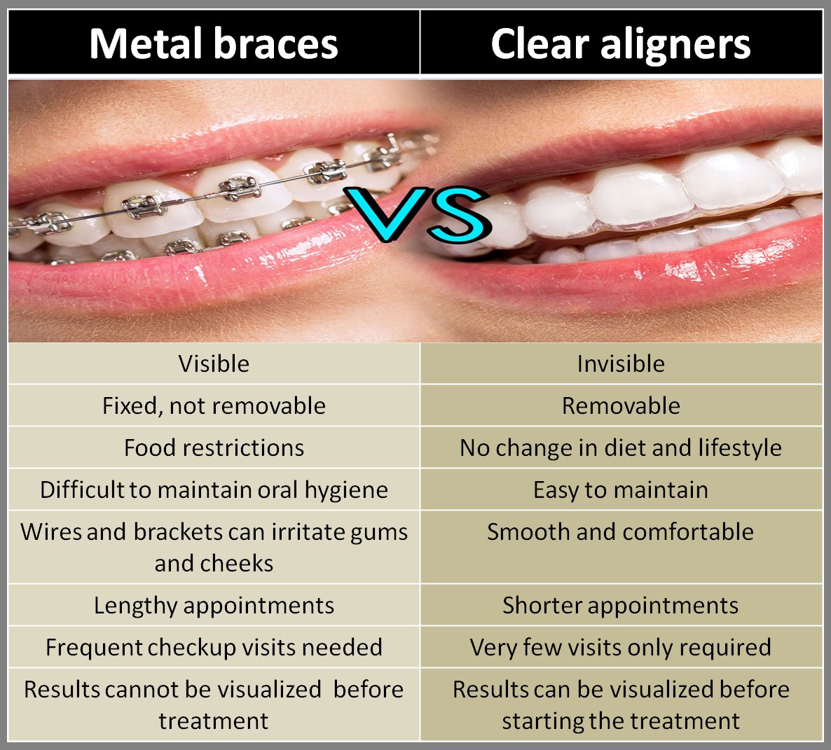 X on X: Metal Braces VS Clear Aligners #orthodontics #dental