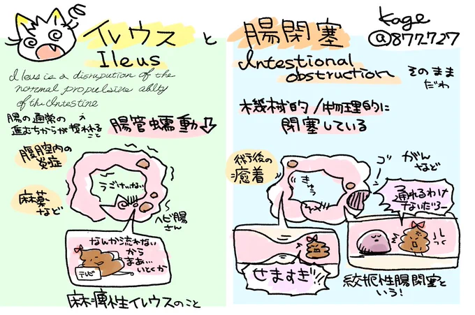 【イレウスと腸閉塞めも】
さいきん日本でも分けて呼ぶイレウスと腸閉塞。
急性腹症では保存的、待機的な治療をするか、手術やIVR・ICU管理が必要かなど、大きく治療が変わるので患者さんがどのような状態になっているかを観察や、検査データなどで把握していく 