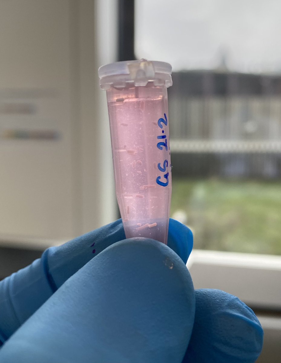 The biggest single/individual muscle fibres I’ve ever come across…