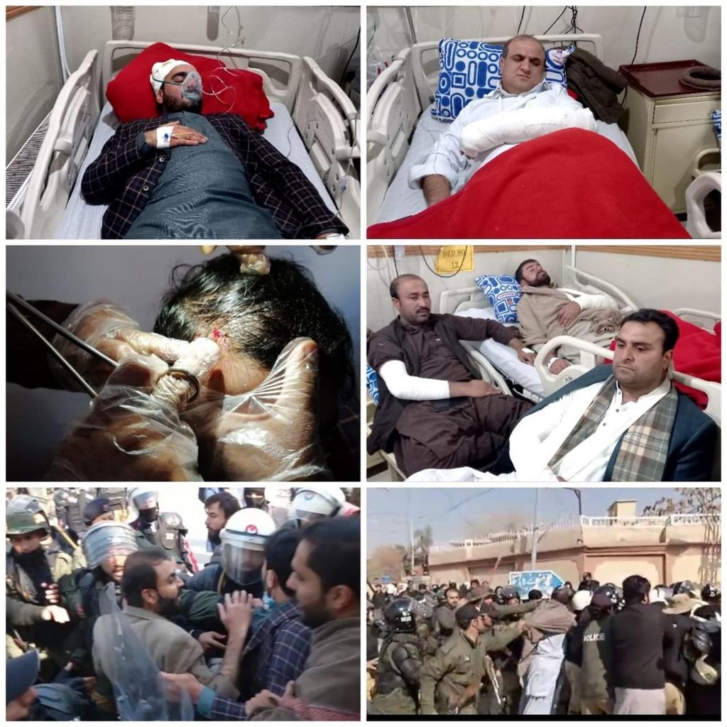 AbdulLateef319's tweet photo. They were demanding facilities for the government hospitals just for the poor people of the province Balochistan
#ShameOnCMBalochistan https://t.co/7b6Oi5wmz0