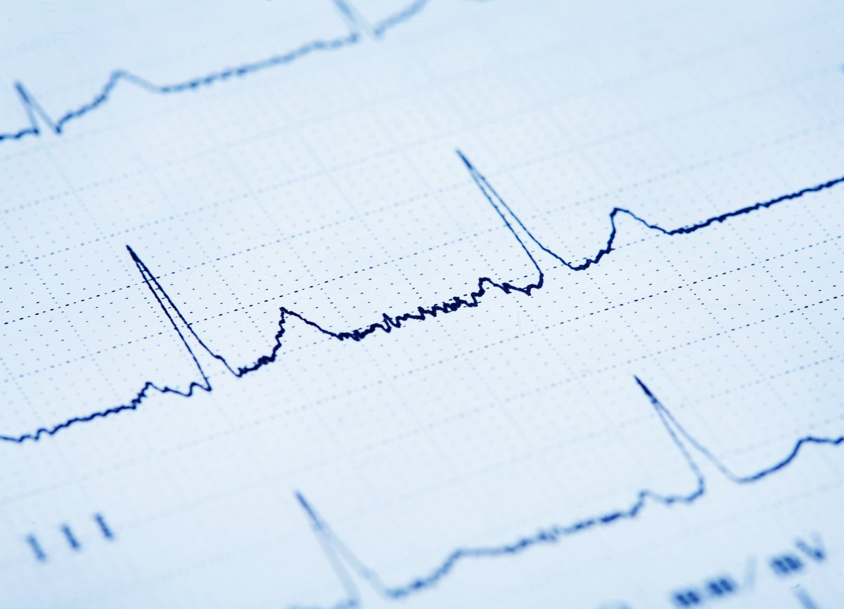 Heart Centre Hasselt tweet media