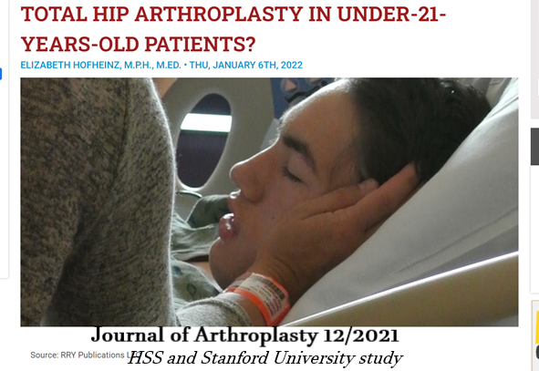 seanthompsonmd's tweet photo. DOC AM I TOO YOUNG TO HAVE A HIP REPLACEMENT?
Recent study outlines decision for arthroplasty to treat these young patients most commonly for osteonecrosis.
Reasons for increase
1.increased longevity and decreased wear rates
2. increased patient awareness of and access https://t.co/vap1U2s3o2