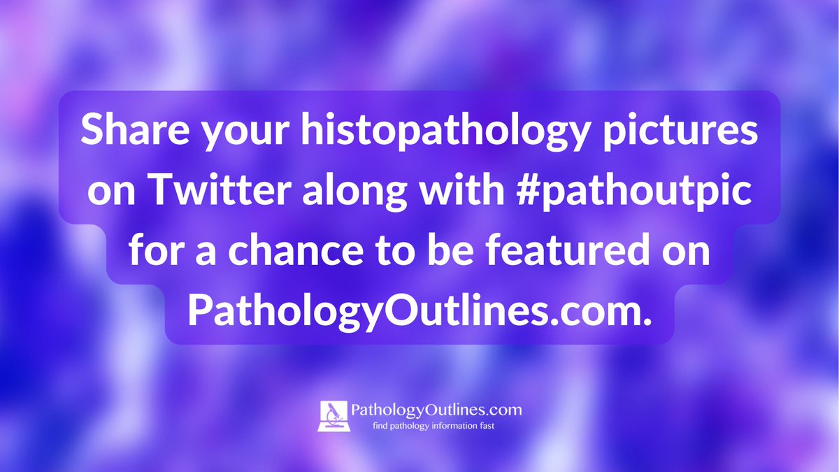 We are publicizing the use of #pathoutpic to identify possible histopathology images to add to our online textbook. If you tweet high-quality histopathology images and are willing to grant permission to use them on PathologyOutlines.com, please include #pathoutpic in your post.