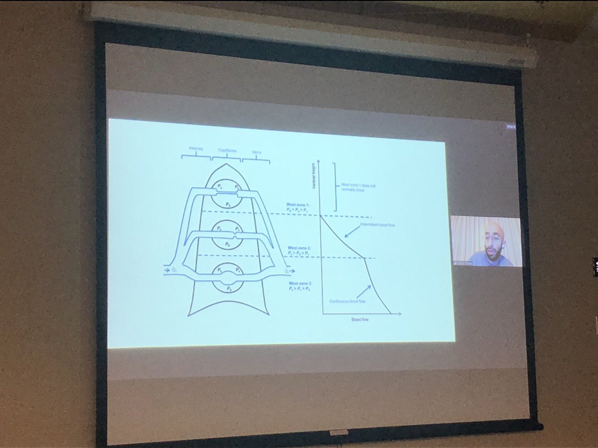 Today our <a href="/bcehs/">Jasmine Kaur Mann</a> <a href="/critcare_medics/">BCEHS Flight Paramedics</a> from PG are being taught everything respiratory from our physician educator Dr. Thiara. CoVID and training in <a href="/Northern_Health/">Northern Health</a> region necessitates different education models but it works well! <a href="/FAB_2016/">FAB2016</a> <a href="/_Brian_Mc_/">Brian McNamara</a>