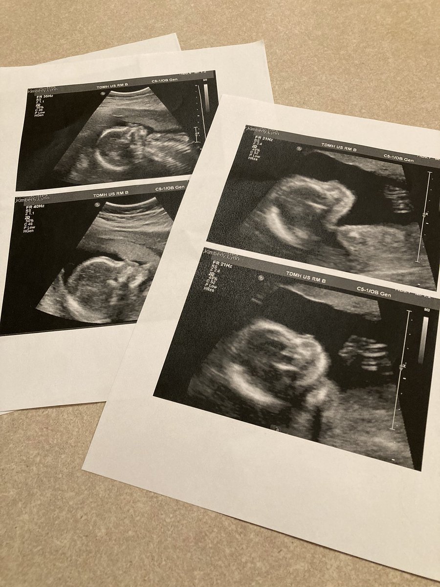 Andy Pasztor 🧼🧽 tweet media