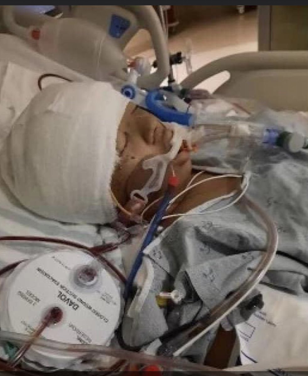 Can ya’ll please say a prayer for this 14 year old North Paulding High student who was hit by a driver as she walked in front of her school. She had to have brain surgery and remains in the ICU. More details at 4. <a href="/wsbtv/">WSB-TV</a>