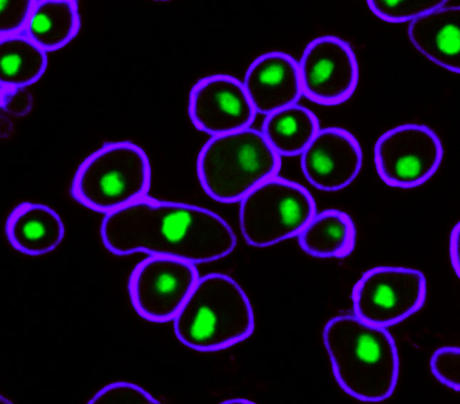 Orna Cohen-Fix (@ornacf) on Twitter photo Postdoctoral position available: Do you know what makes the nuclear envelope expand? We don’t either, but we are trying to find out! We have an appealing approach (and preliminary data...) using budding yeast. If you like genetics and cell biology, DM or email ornac@niddk.nih.gov Postdoctoral position available: Do you know what makes the nuclear envelope expand? We don’t either, but we are trying to find out! We have an appealing approach (and preliminary data...) using budding yeast. If you like genetics and cell biology, DM or email ornac@niddk.nih.gov