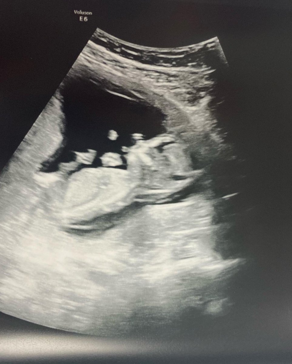 Anne Bianchi Emmons Ed.S.,NBCT tweet media