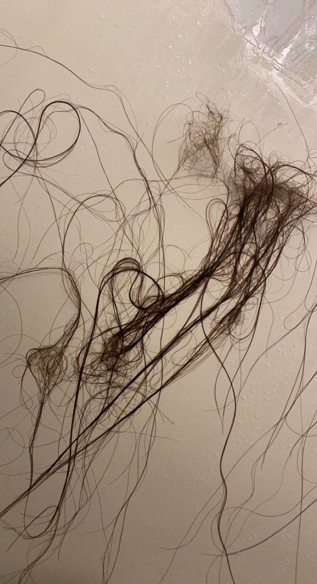 Anybody else have their hair falling out in clumps because of covid… because this is ridiculous