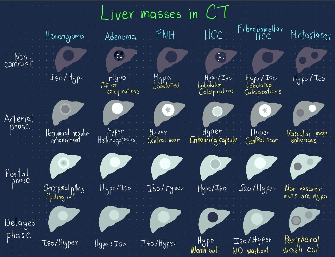 Absite high yield - liver lesions #MedTwitter #abiste #surgeryboards (credit to who ever made them )