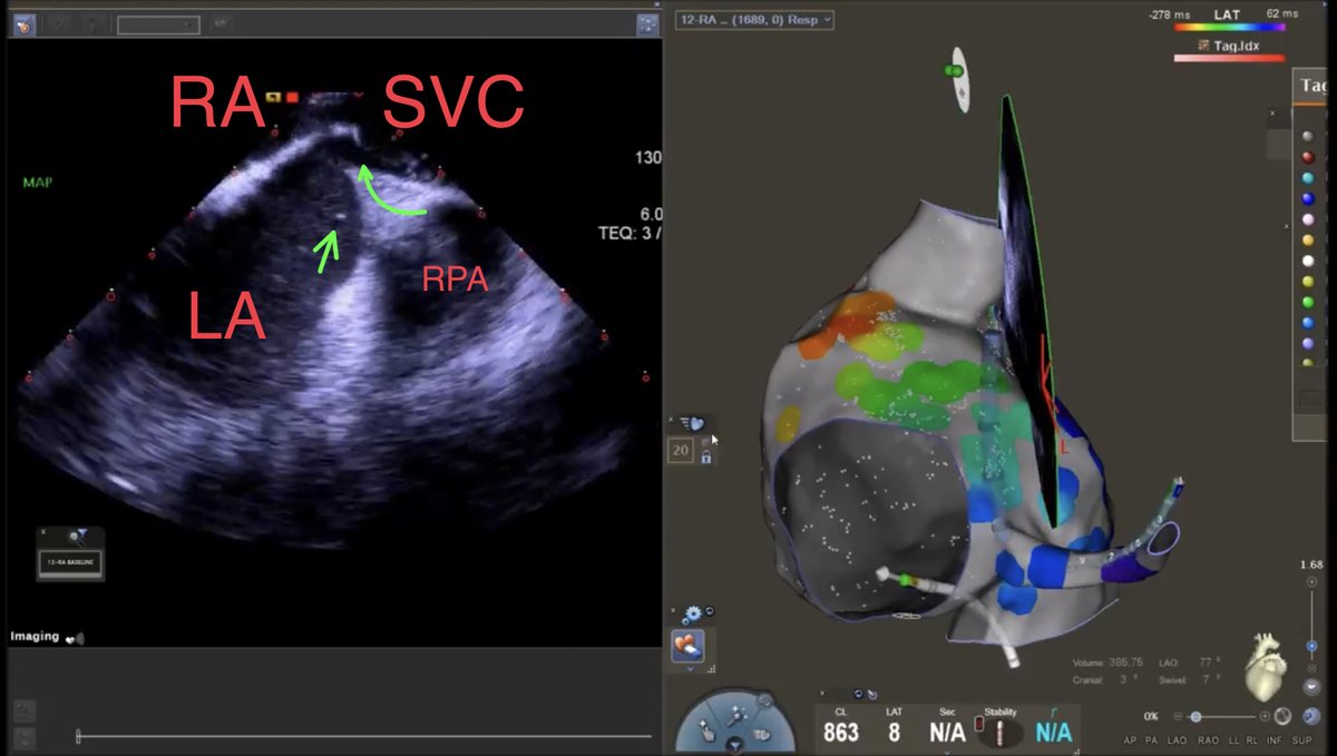 Jeffrey M Vinocur tweet media
