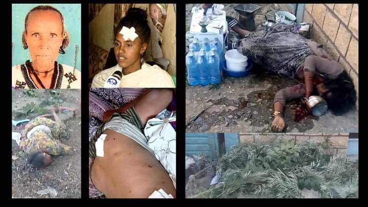 HelenBe98049469's tweet photo. Victims of drone attack in Dedebit, #Tigray that killed 56 & injured >100. Civilians are being systematically targeted.💔Another attack targeted Women & Children Killed Civilians in #Hiwane .#CallItAGenocide
#NoFlyZoneInTigray
@SenatorRisch @POTUS @NATO @ChrisCoons @UN https://t.co/aMtjNPdist