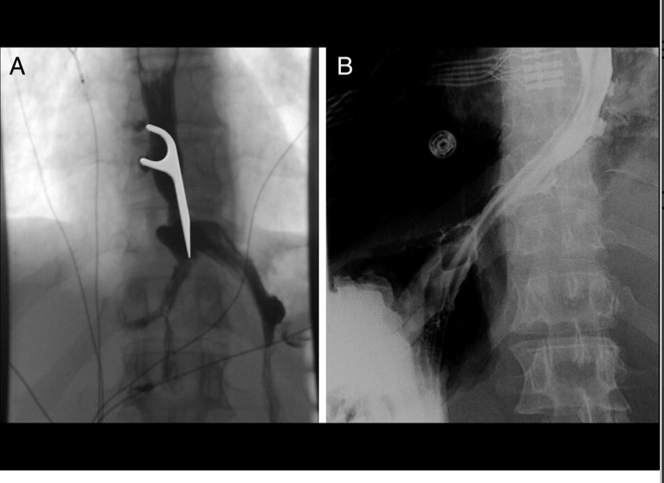 Ronald Samuel MD tweet media