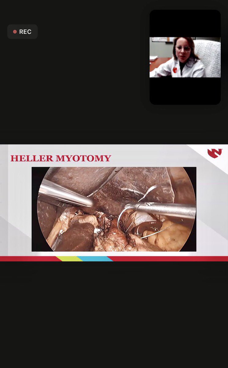 First Grand Rounds talk as an Attending ✅ Thanks to <a href="/tfarrellunc/">Tim Farrell</a> and <a href="/EzraTeitelbaum/">Ezra Teitelbaum</a> for your guidance and videos! #collaboration #SoMe4Surgery #AcademicTwitter <a href="/UNMCSurgery/">University of Nebraska General Surgery Residency</a> <a href="/UNCSurgery/">UNC Surgery</a> <a href="/NMSurgery/">Northwestern Surgery</a>