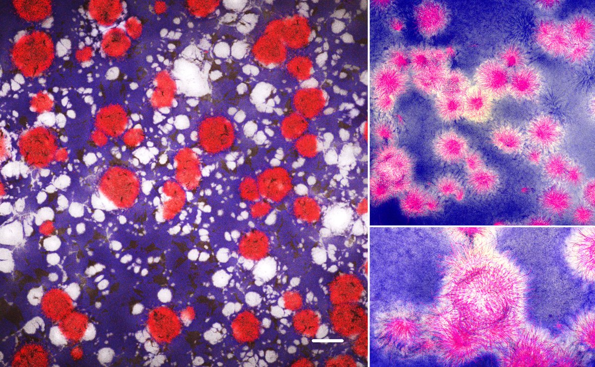 ukbiofilms's tweet photo. 🎉Happy New Year from all of us here at NBIC!

All of these images are from our #Biofilm Image Gallery, which contains a selection of beautiful entries from our #BiofilmsInTheLab &amp; #BiofilmsIRL photography competitions! 

🔎https://t.co/ToeMKGw2lC #BiofilmAware https://t.co/N0pGAyimV6