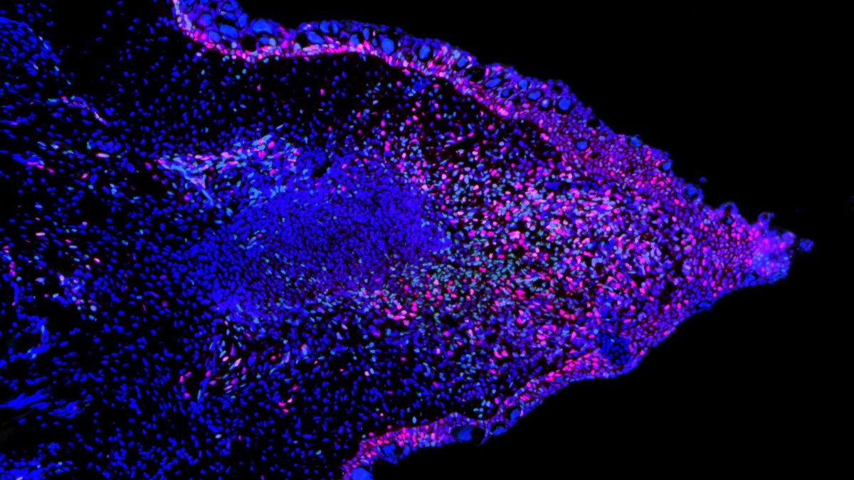 IMP (@impvienna) on Twitter photo Happy 2022! Thanks to all participants for this fun end of year. We will contact the winners in the coming days. 🎁🥳
These cells belong to a #blastema in an axolotl's regenerating hind limb.
Thanks to <a href="/Nasechkas/">Anastasia Polikarpova</a>, postdoc in the <a href="/Tanaxolotl/">Elly Tanaka</a> Lab, for this final image! Happy 2022! Thanks to all participants for this fun end of year. We will contact the winners in the coming days. 🎁🥳
These cells belong to a #blastema in an axolotl's regenerating hind limb.
Thanks to <a href="/Nasechkas/">Anastasia Polikarpova</a>, postdoc in the <a href="/Tanaxolotl/">Elly Tanaka</a> Lab, for this final image!