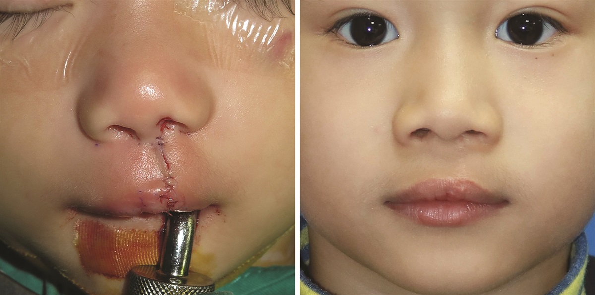 Plastic and Reconstructive Surgery tweet media