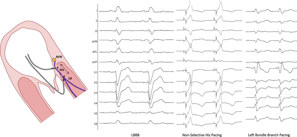 Heart_BMJ tweet media