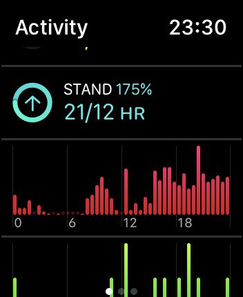 nazhan21's tweet photo. Have been awake for the past 21/24 hours for no reason. At the point where you’re just too tired to sleep. https://t.co/XR9JtBop9a