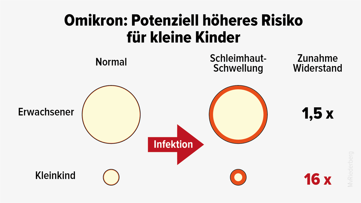 SichereSchule's tweet photo. Omikron v.a. für Geimpfte etwas milder (wie auch Delta). Für Ungeimpfte macht die höhere Infektiosität das wett. Für kleine Kinder ist Omikron aber potenziell gefährlich. Wieso? 
Das erklären wir hier:
https://t.co/brBgXT82xO

#ProtectTheKids #FernunterrichtJetzt https://t.co/zGrW1QHMdS