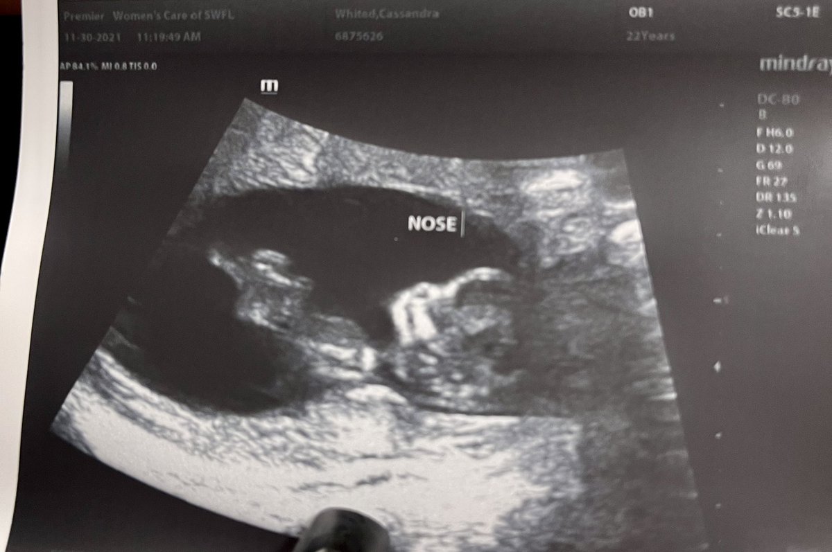 DFRIGA98 tweet media