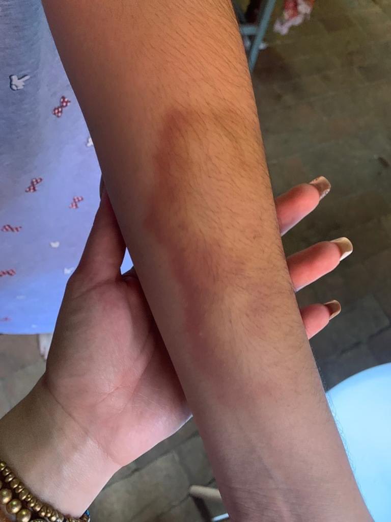 ClarissaaDuarte's tweet photo. No se imaginan la impotencia que siento cuando mi amiga me dice “búscame” y le encuentro de esta forma. Maltratada por el “novio”. Asco de ser humano eso sos AARON MARTÍNEZ. NO se callen chicas. Nunca se callen 😭💔 https://t.co/I0vnEAdyuJ