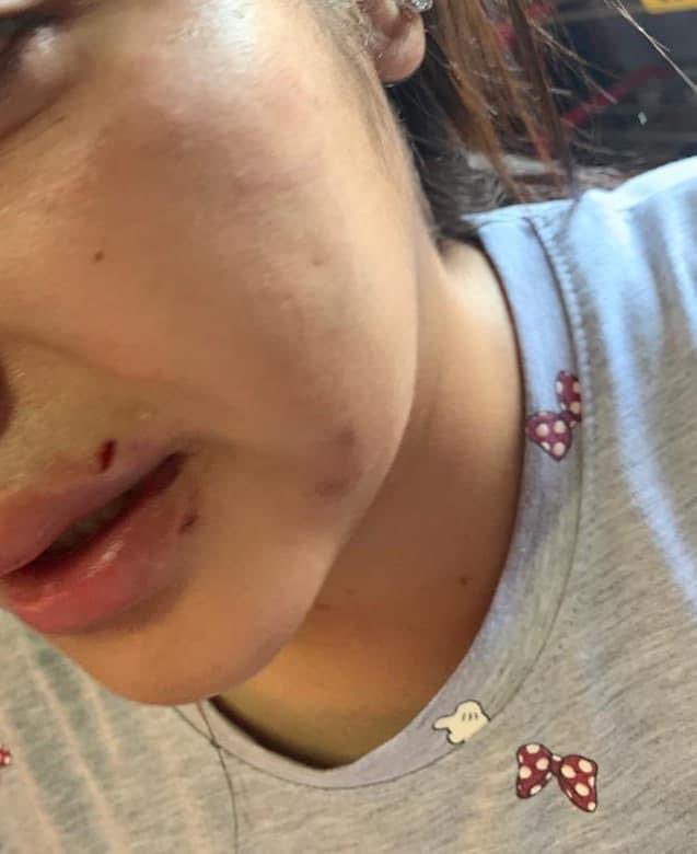 ClarissaaDuarte's tweet photo. No se imaginan la impotencia que siento cuando mi amiga me dice “búscame” y le encuentro de esta forma. Maltratada por el “novio”. Asco de ser humano eso sos AARON MARTÍNEZ. NO se callen chicas. Nunca se callen 😭💔 https://t.co/I0vnEAdyuJ