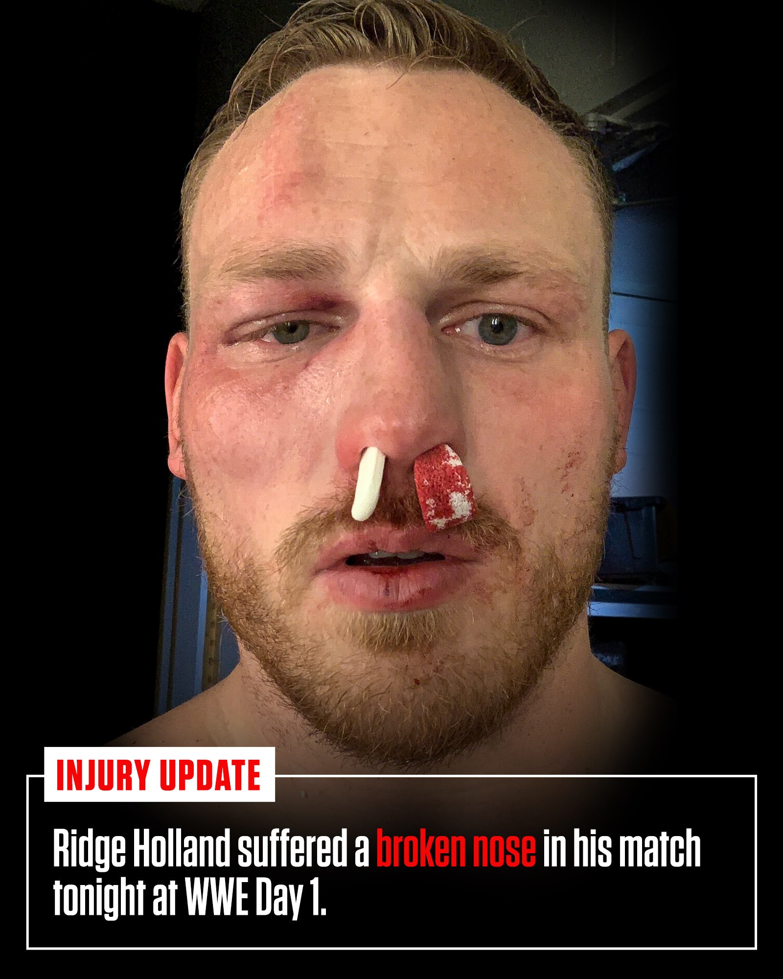 WWE Day 1: Top Smackdown Superstar’s Injury Officially Announced 2