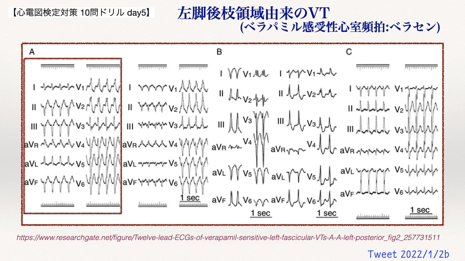 N. Tsukishima EP大学心電図検定学部試験対策科担任 on X: 