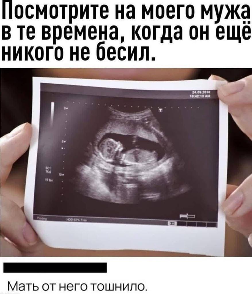Ребёнок в 12 недель беременности скрининг