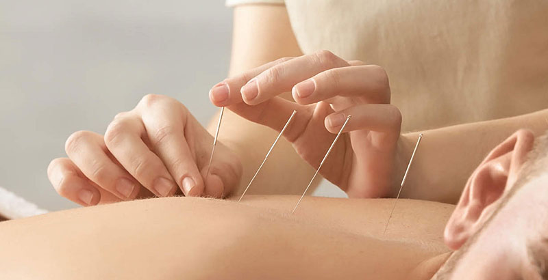 Acupuncture ~ An Ancient Way of Achieving Renewed Wellness pvangels.com/healthcare/new…… Acupuncture exactly is it and how does it work? #PuertoVallarta #RivieraNayarit #health #healthylifestyle #medicalinformationhealth #HealthyLiving #medicalinformation